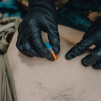 RHINO RESCUE Pneumothorax Needle - Rhino Global Store