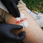 RHINO RESCUE Wound Closure Kit - Rhino Global Store